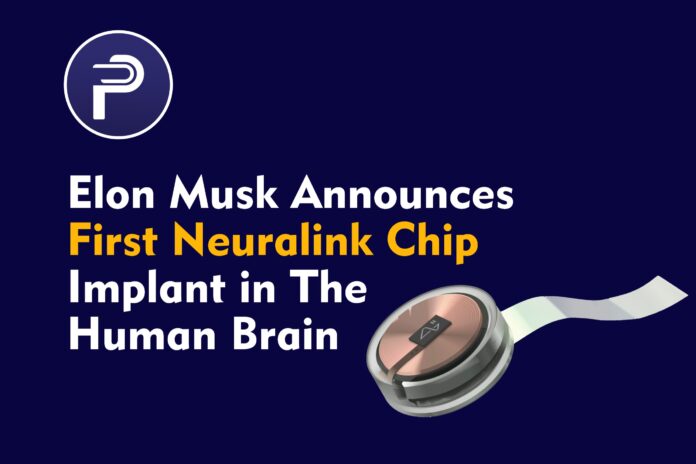 Elon Musk Announces First Neuralink Chip Implant in The Human Brain